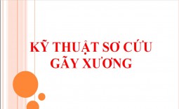 KỸ THUẬT SƠ CỨU GÃY XƯƠNG