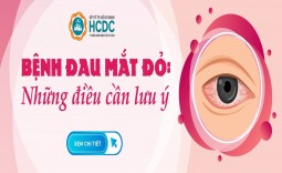 BỆNH ĐAU MẮT ĐỎ